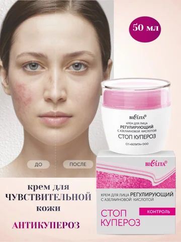 Стоп купероз Крем для лица регулирующий 